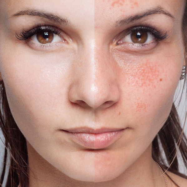 skin-blemishes-mainweb